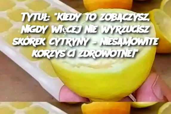 Tytuł: "Kiedy to zobaczysz, nigdy więcej nie wyrzucisz skórek cytryny – niesamowite korzyści zdrowotne!"