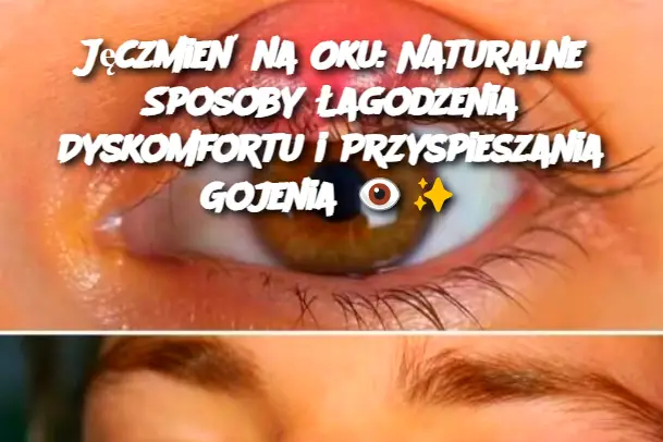 Jęczmień na Oku: Naturalne Sposoby Łagodzenia Dyskomfortu i Przyspieszania Gojenia