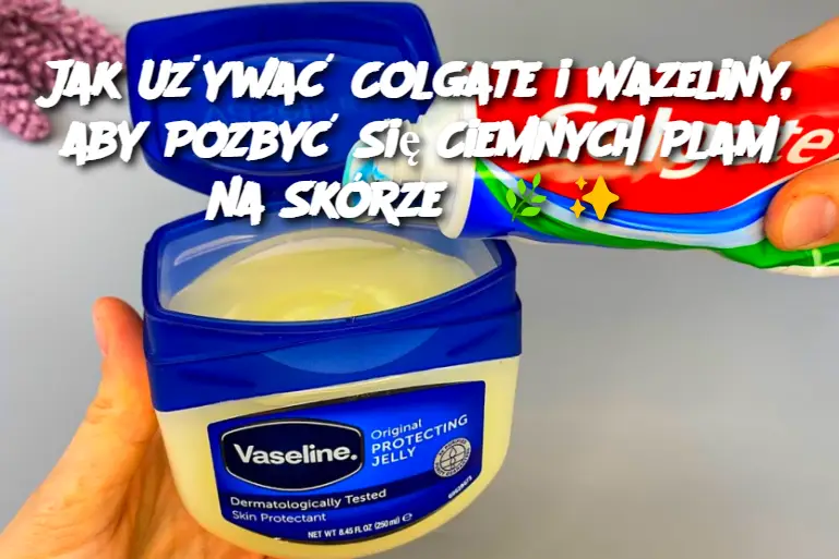 Jak Używać Colgate i Wazeliny, aby Pozbyć Się Ciemnych Plam na Skórze?