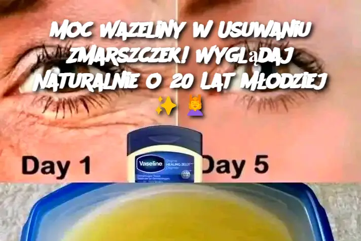 Moc Wazeliny w Usuwaniu Zmarszczek! Wyglądaj Naturalnie o 20 Lat Młodziej