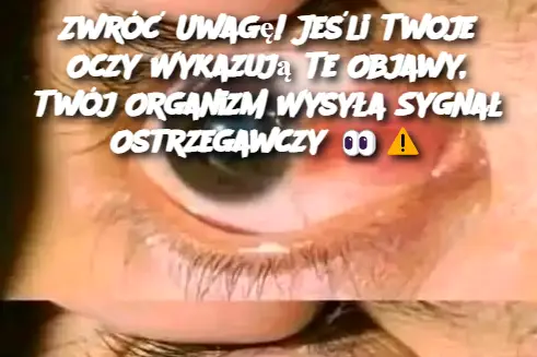 Zwróć Uwagę! Jeśli Twoje Oczy Wykazują Te Objawy, Twój Organizm Wysyła Sygnał Ostrzegawczy