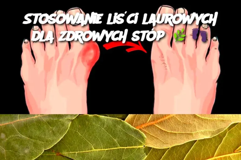 Stosowanie liści laurowych dla zdrowych stóp