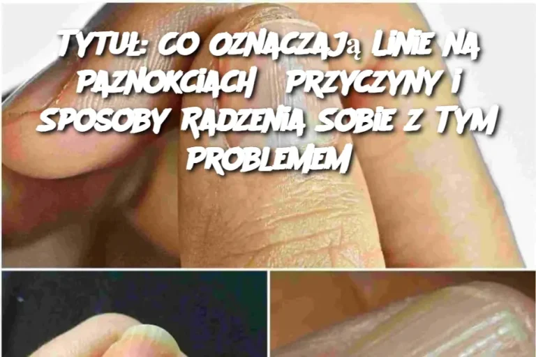 Tytuł: Co Oznaczają Linie na Paznokciach? Przyczyny i Sposoby Radzenia Sobie z Tym Problemem