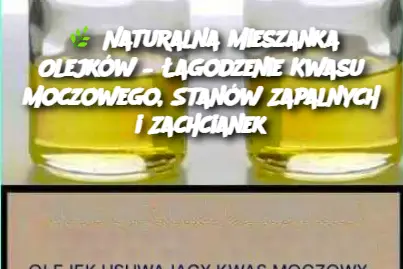 Naturalna Mieszanka Olejków – Łagodzenie Kwasu Moczowego, Stanów Zapalnych i Zachcianek