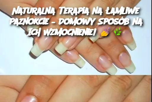 Naturalna Terapia na Łamliwe Paznokcie – Domowy Sposób na Ich Wzmocnienie!