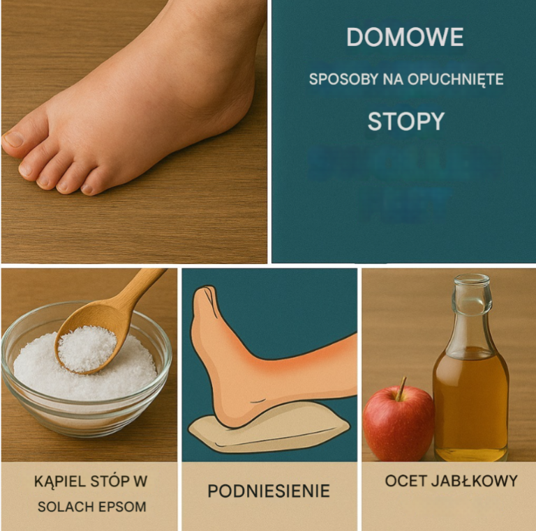 Domowe sposoby na opuchnięte stopy – ulga, którą masz pod ręką