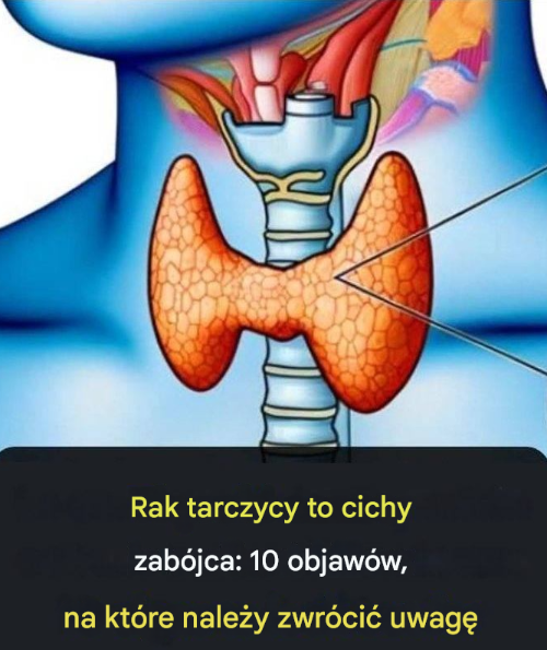 Rak tarczycy to cichy zabójca: 10 objawów, na które należy zwrócić uwagę