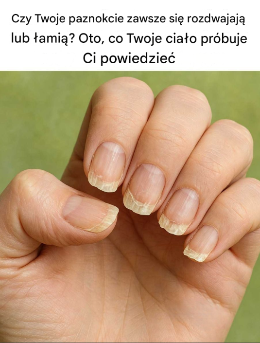 Czy Twoje paznokcie zawsze się rozdwajają lub łamią? Oto, co Twoje ciało próbuje Ci powiedzieć