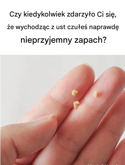 Kamienie migdałkowe: dowiedz się, czym są, jak wyglądają i jak pozbyć się ich na zawsze