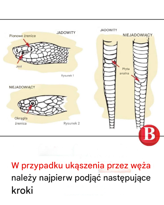 W przypadku ukąszenia przez węża należy najpierw podjąć następujące kroki